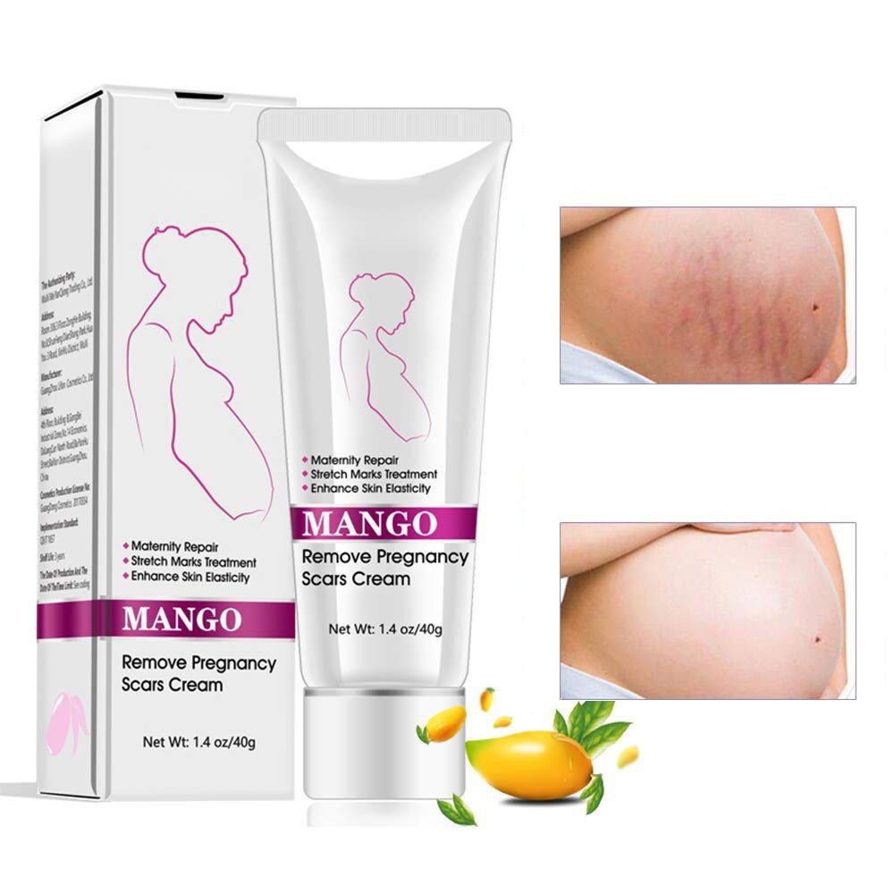 cream for removal of stretch marks