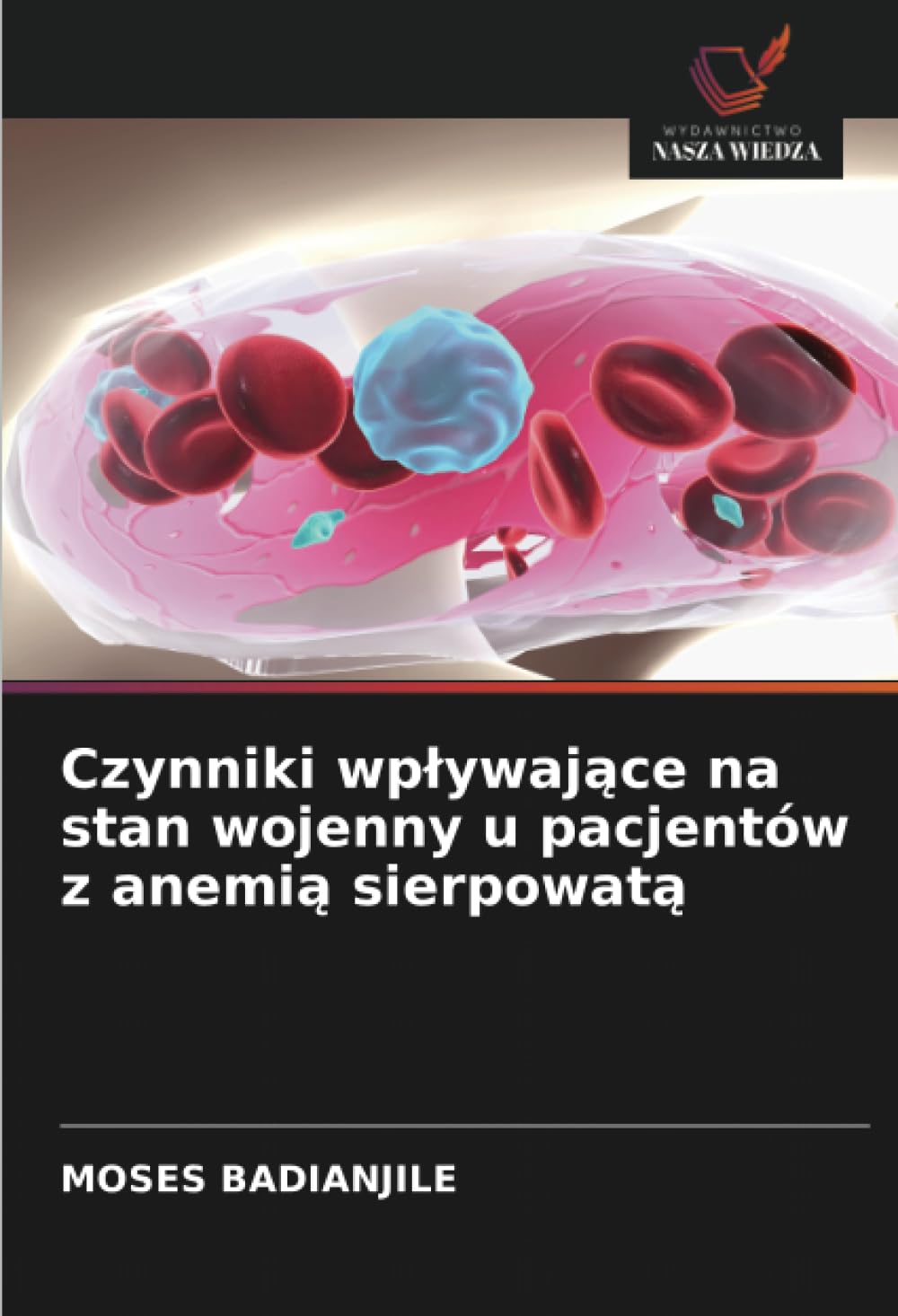 Czynniki wplywające na stan wojenny u pacjentów z anemią sierpowatą