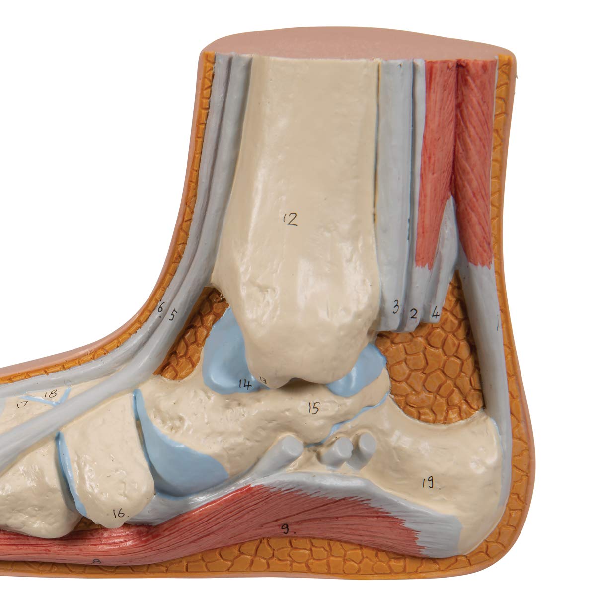 3B Scientific M31 płaska stopa, Pes Planus darmowe oprogramowanie anatomiczne - 3B Smart Anatomy