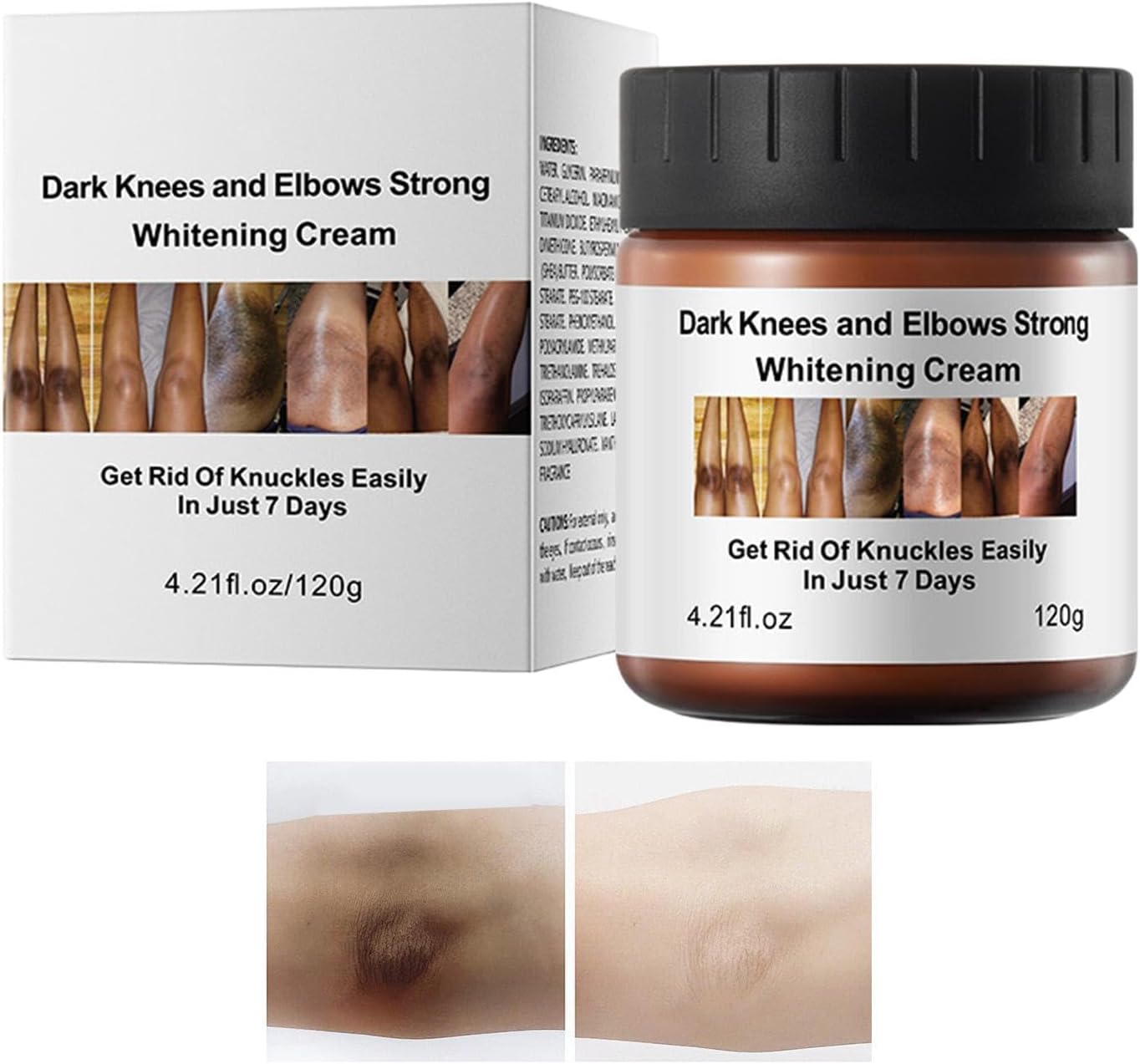 Brightening Cream Dark Knees, Lightening Tone Lotion, Skin Care Balm with Daily Comfort, Compact Pack Utility with Quick Absorption, Beauty Cosmetic, Longtail Whitening Aid for Morning Routine Use