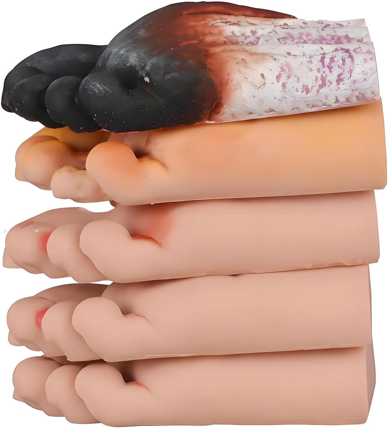 Teaching Model Tool,5 Pcs Diabetic Foot Care Model 1-5 Diabetic Foot Nursing Simulator Model Foot Model for Diabetic Care and Pedicure Practice