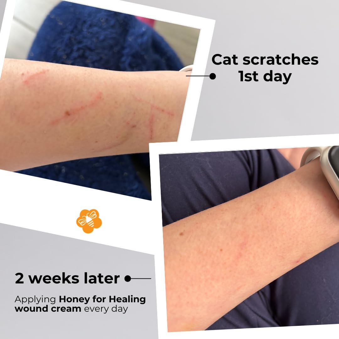 Authentic Manuka Honey First Aid Skin Care for Minor Cuts, Burns, Scrapes, Blisters & Really Dry Skin | Non-Sticky, Gentle Formula (1.75 oz / 50 g)