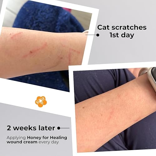 Miniatura 4 de Crema de miel de Manuka con UMF 15+, fórmula no pegajosa de absorción rápida para cortes, quemaduras, rasguños, lesiones menores – 1.75 oz / 50 g