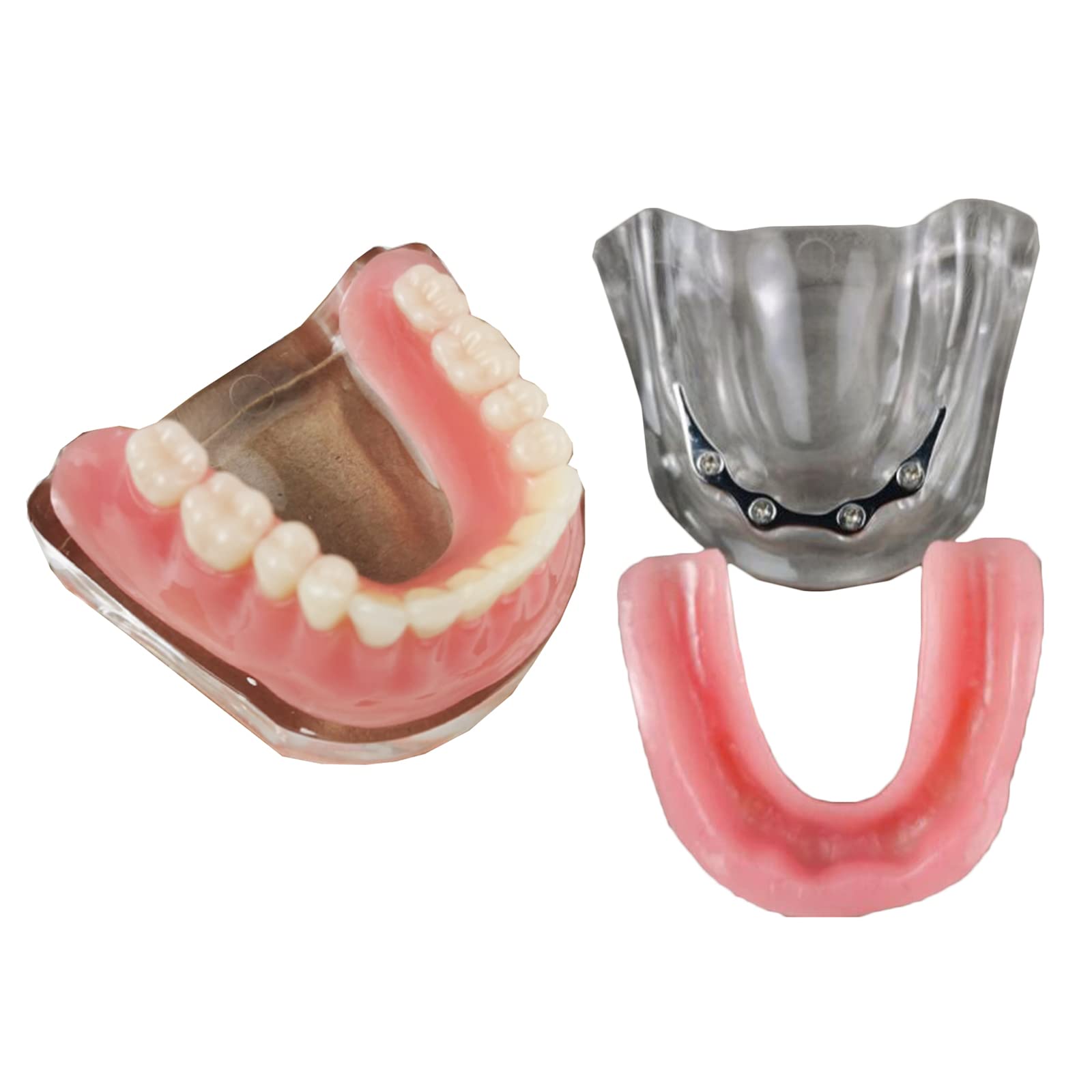 Model demonstracyjny zębów, wyjmowany implant, analiza, model odbudowy zębów do nauczania zębów lub pielęgnacji jamy ustnej
