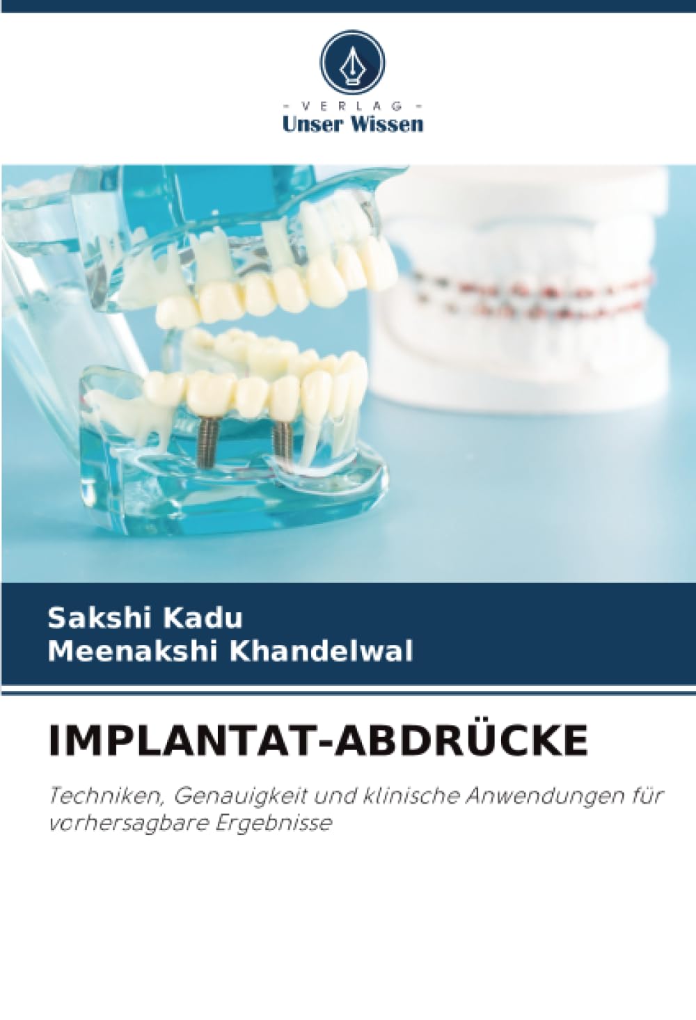 IMPLANTAT-ABDRÜCKE: Techniken, Genauigkeit und klinische Anwendungen für vorhersagbare Ergebnisse