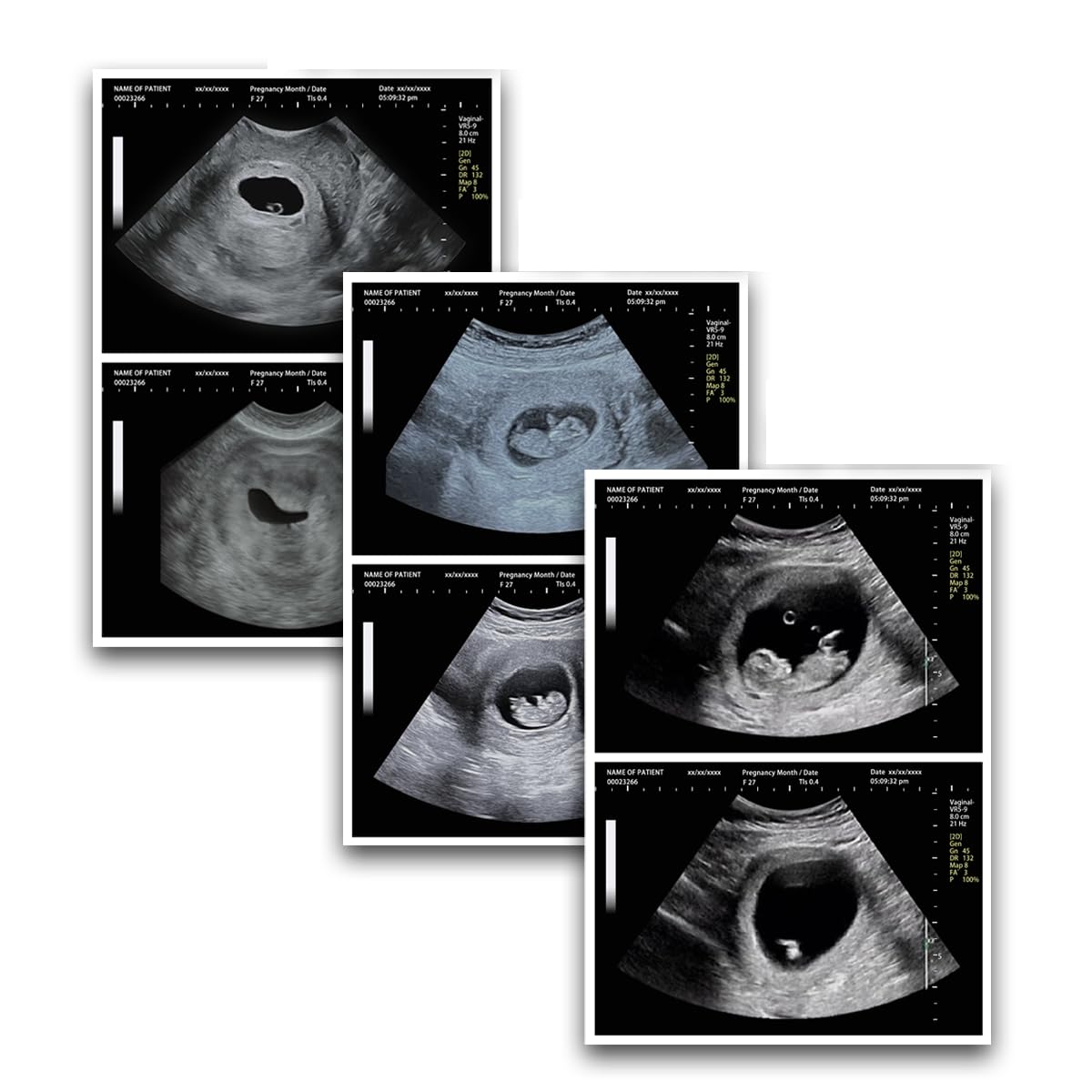 Fake Pregnancy Ultrasound Picture - Funny Ultrasound Photo Joke Items, Realistic Baby Scan Pictures, Funny Gift for Couples, Husband, Wife, Partner, Surprise, Fun