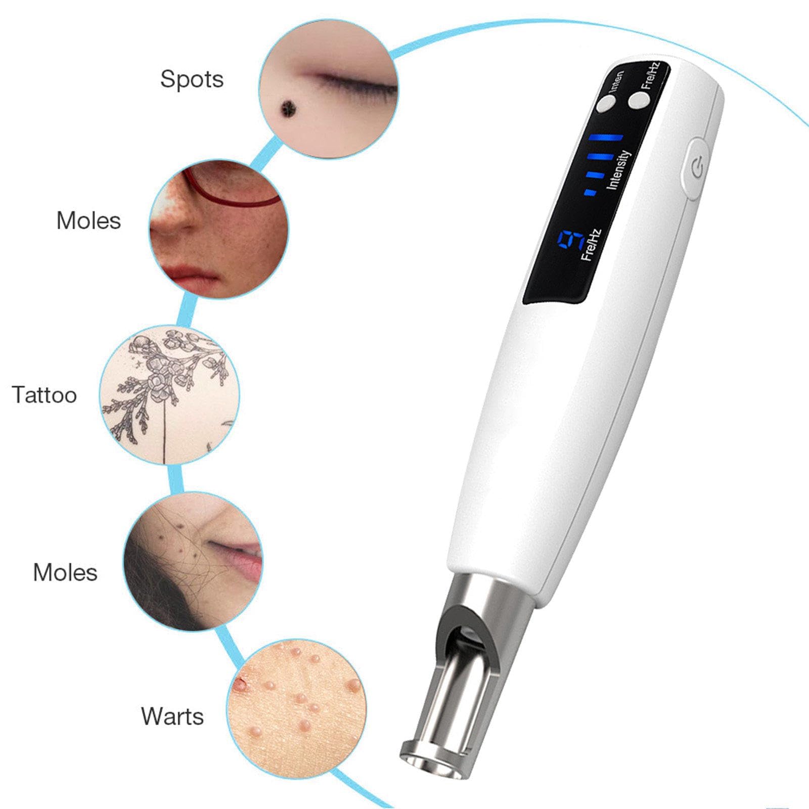 Picosekunden-Stift für zuhause zur Entfernung von Sommersprossen, Muttermalen und Pigmentflecken, LCD-Anzeige, Blaulicht, 9 Modi,Rot