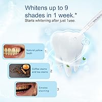 Vista 4 de Luz de blanqueamiento de dientes, 32 luces LED roja y azul, sistema inteligente de blanqueamiento de dientes, acelerador de luces LED azules con USB