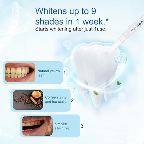 Miniatura 4 de Cmzxc Luz blanqueadora de dientes, 32 luces LED roja y azul, sistema inteligente de blanqueamiento de dientes, acelerador de luces LED azules con