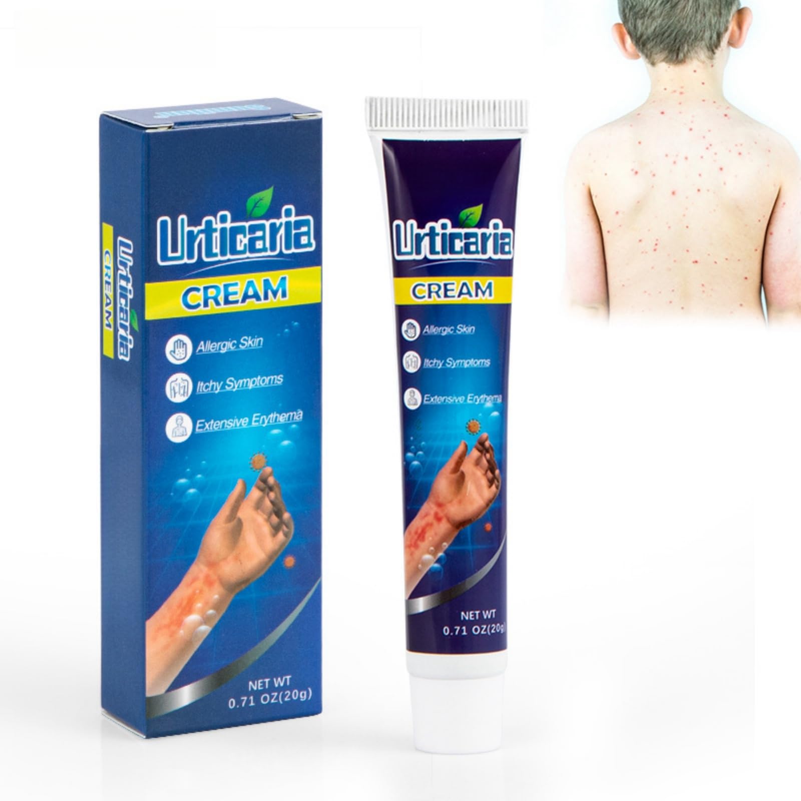 HONPOLO Urticaria Cream - 20g Relief for Allergic Skin - Soothes Itchy Symptoms - Reduces Extensive Erthema - Assists in Repairing Irritated Skin - Hypoallergenic and Gentle Formula - Fast-Acting