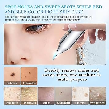 9 Levels Laser Plasma Pen, Skin Tag Removal Pen, Mole Freckle Wart Tag Removal Pen Dark Spot Remover for Face, LCD Display and Red Blue Light, Does Not Hurt The Skin