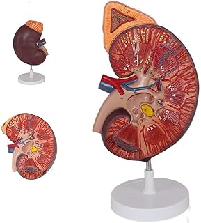 Human Kidney Anatomical Model-Kidney with Adrenal Gland Model (Three Times Magnified), Used for Doctor-Patient Communication and Medical Education