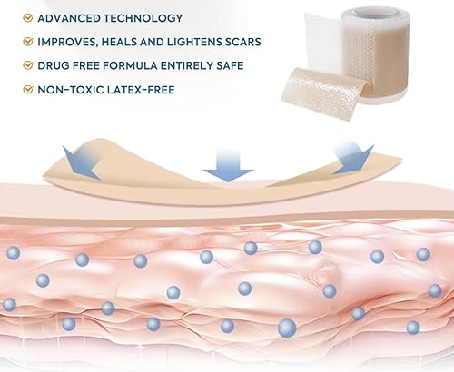 Miniatura 4 de Hojas de silicona para cicatrices de 1.6 x 120 pulgadas, grado médico, de larga duración, rollo de cinta reutilizable para cesárea, cicatrices