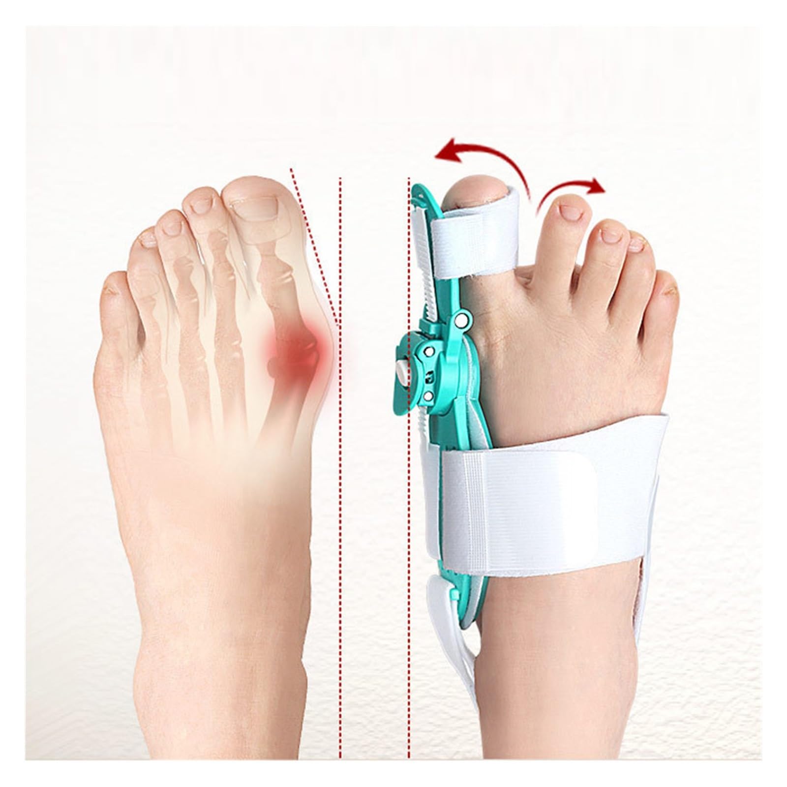 Hallux Valgus Korrektor Ballenzehen, Fuß-Fingerspreizer, Zehenspreizer Ballenzeh-Korrektor, Fingerspreizer, Valgus, Grün, 2 Stück