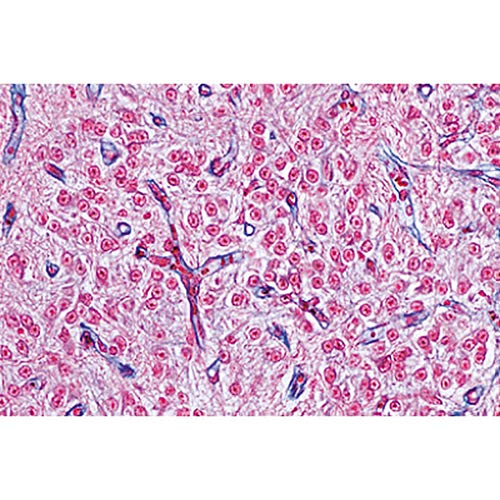 3B Scientific GmbH W13417 Endocrine System Micro. Slides/Set of 5, Grade: 1 to 2