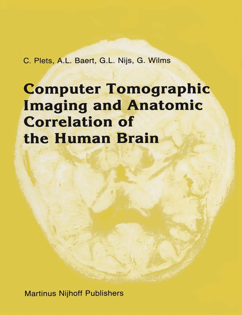 Buy Computer Tomographic Imaging and Anatomic Correlation of the Human