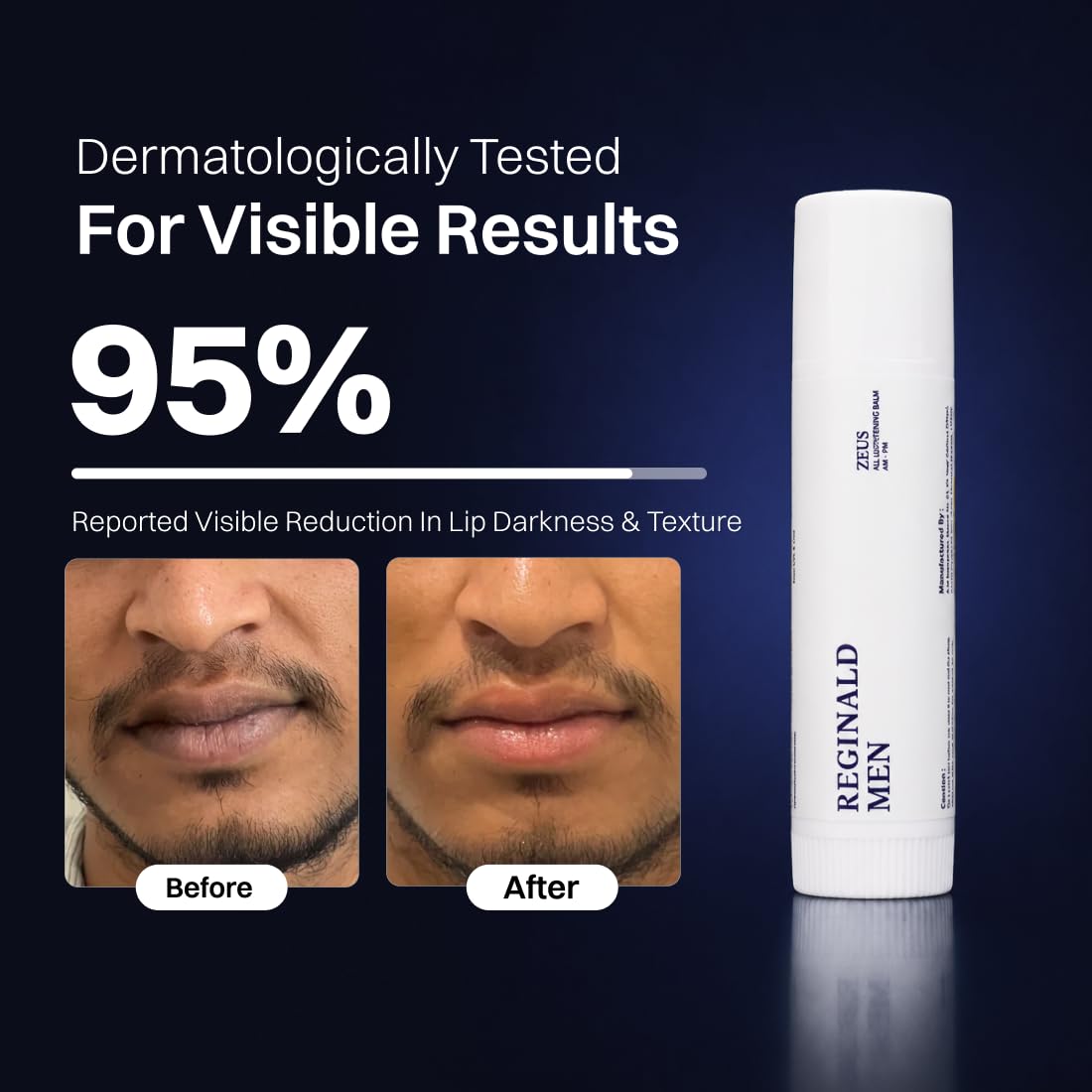 Reginald Men Zeus - Lip Balm SPF 30 PA+++ 5g | Brightens Smoker Lips & Repairs Skin Barrier | Softens & Smoothens Rough Texture | Fights Dryness & Pigmentation, Protects from Sun Darkening 2