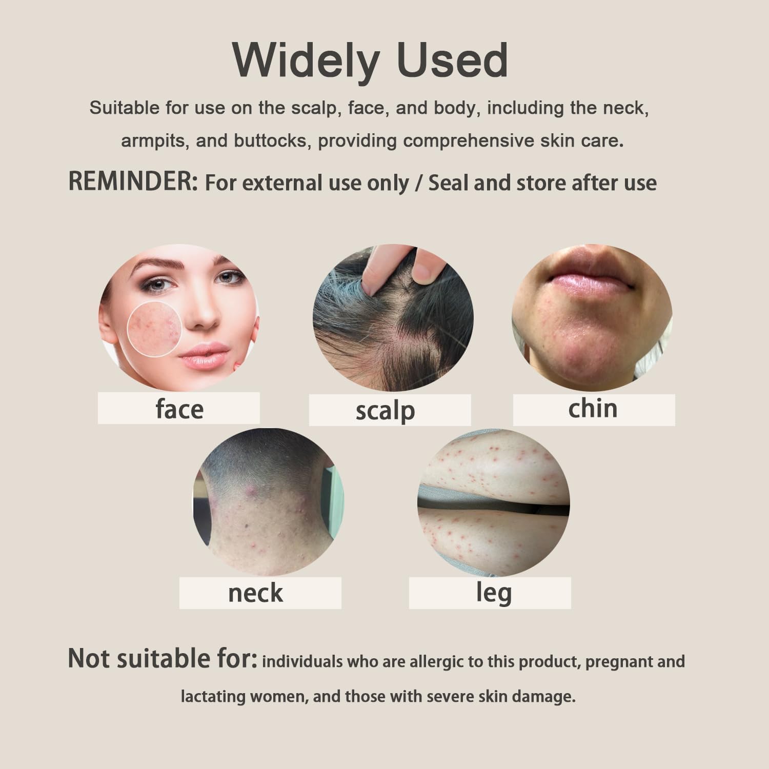 TKTT Folliculitis Cream, Folliculitis Treatment, Effective Treatment for Folliculitis Scalp Face and Body, Redness, Inflammation, Ache, Burning, 1.42Oz - Image 6