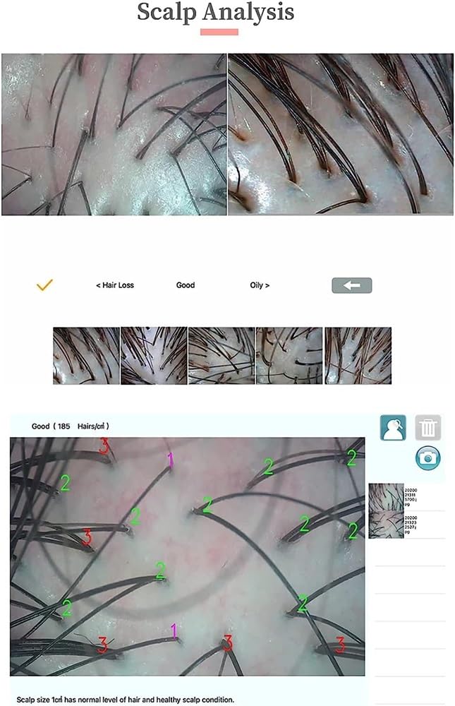 Analyseur de peau, détecteur intelligent for l'analyse des cheveux et du cuir chevelu de la peau et du cuir chevelu, dispositif d'analyse du cuir chevelu au microscope, analyseur facial fluorescent d'