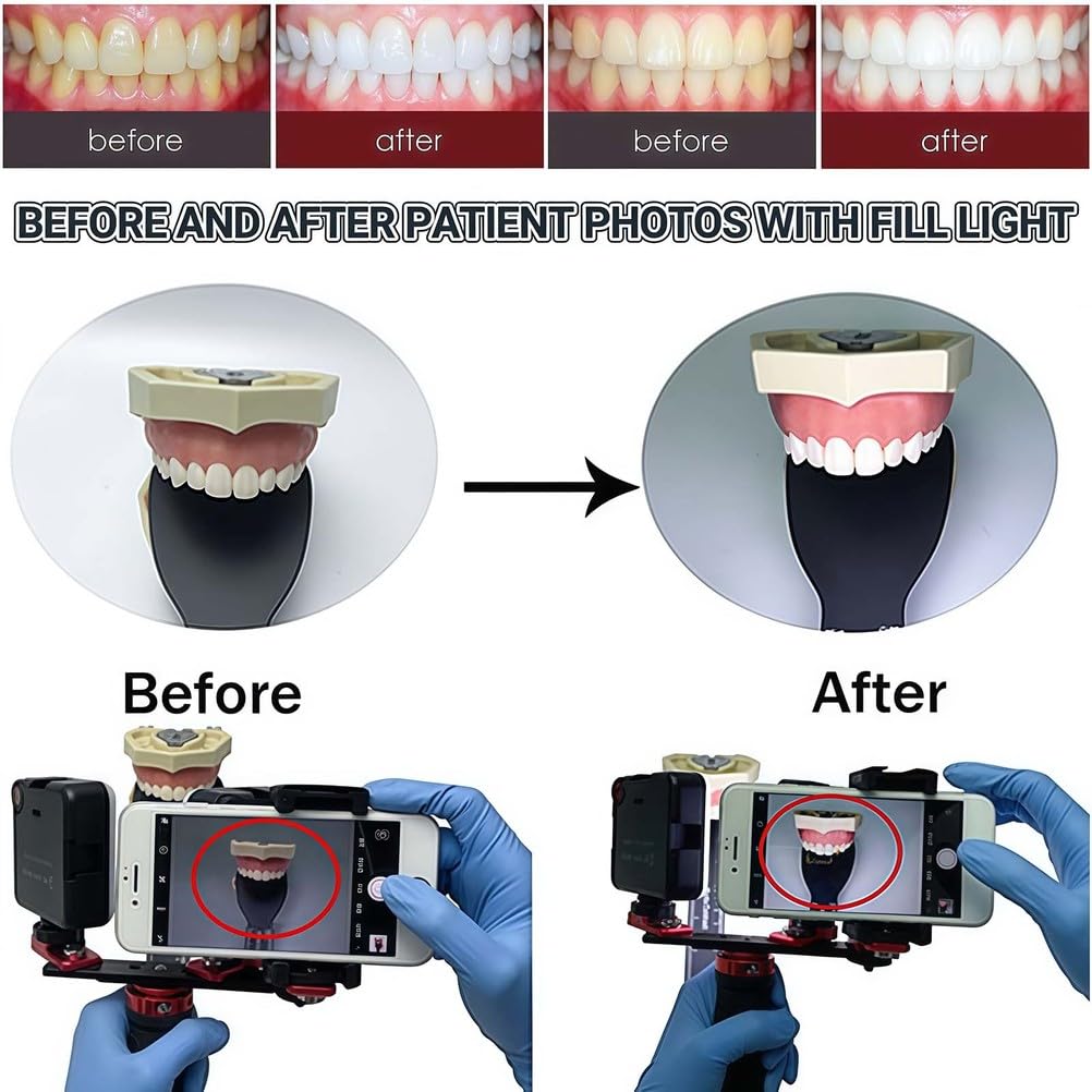 Dental Photography Aid - Supplemento luminoso di riempimento per fotocamere cellulari, ideale per cosmetologia e fotografia macro di prodotti