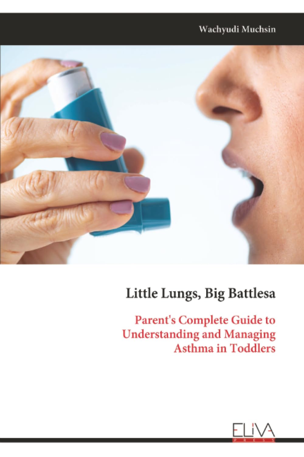 Little Lungs, Big Battlesa: Parent's Complete Guide to Understanding and Managing Asthma in Toddlers