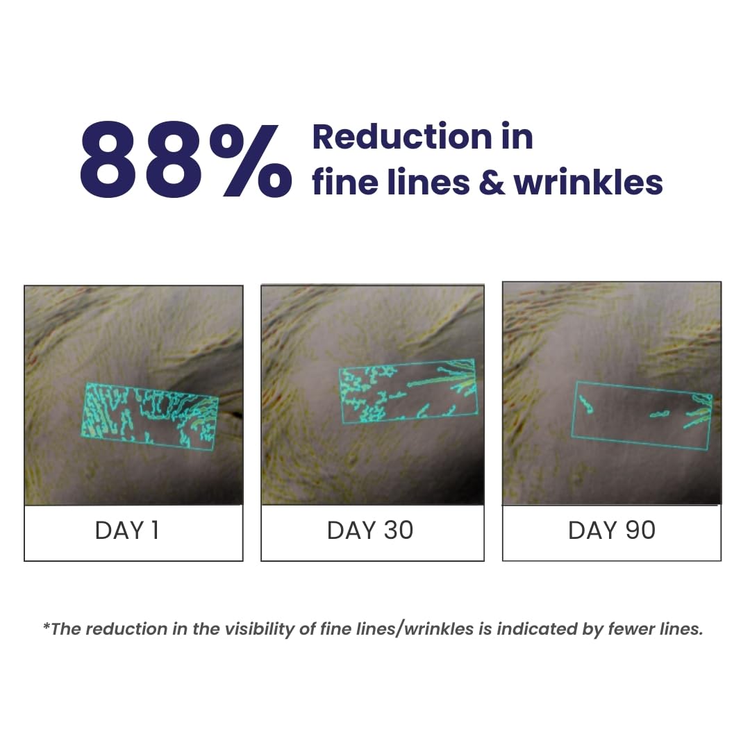 RE' EQUIL 0.1% Retinol Night Cream | Repairs Wrinkles & Fine Lines | Improves Skin Firmness | Beginner Friendly | All Skin Types | Anti Aging Cream For Women & Men 32G 3