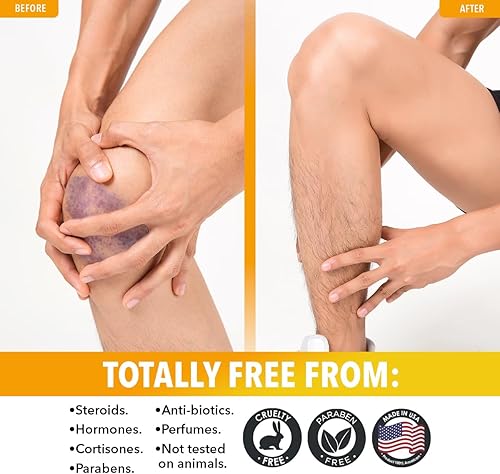 Miniatura 5 de Dr. Robaina Arnica Bruise Roll-On de 3 onzas  Arnica Montana de grado USP y vitamina K  Rodillo de secado rápido y sin desorden que reduce