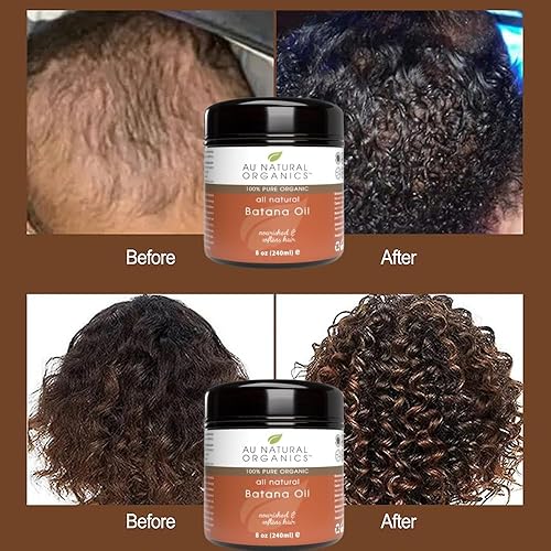 Miniatura 7 de Aceite de batana para el crecimiento del cabello  Aceite de batana orgánico aprobado por Dr. Sebi & Dr Truth para el crecimiento del cabello,