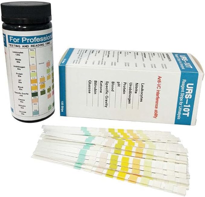 ATIN 100 Strips URS10T Reagent Urinalysis Strips,Urine Infection Test