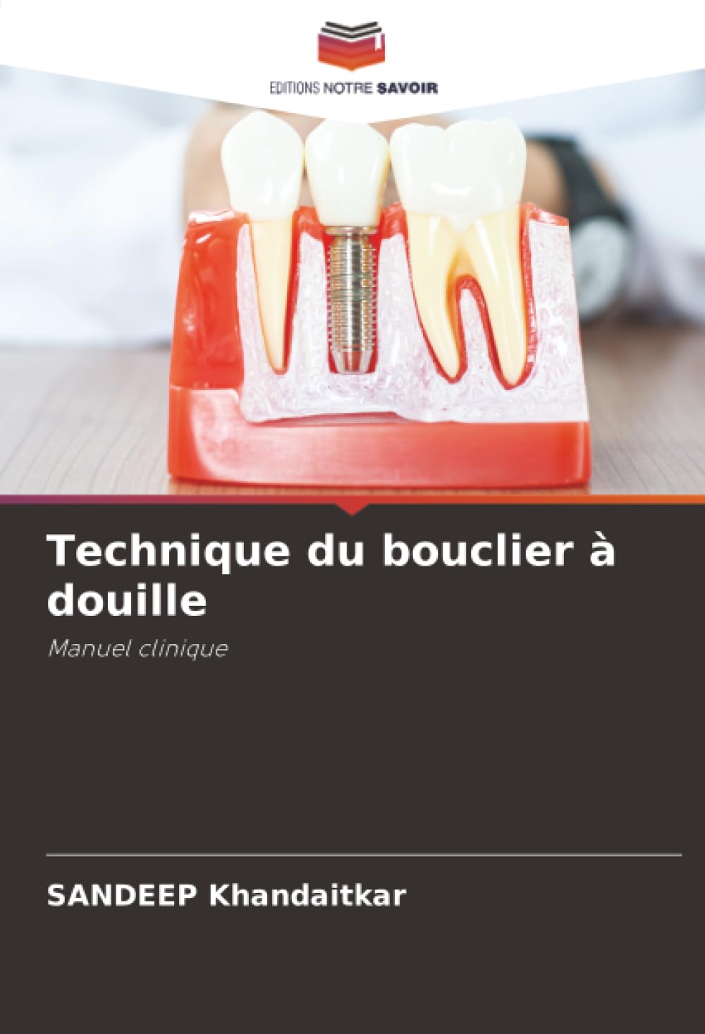 Technique du bouclier à douille: Manuel clinique