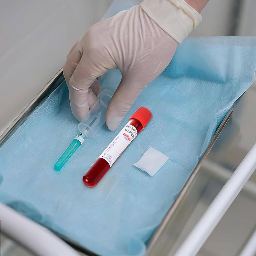 Provetta per Prelievo di Sangue Rosso,3Ml/5Ml/10Ml,Provette per Centrifuga,Provette per Prelievo di Sangue sotto Vuoto,Pressione Negativa,per Test di Laboratorio,Animali,100 Pezzi,5ml
