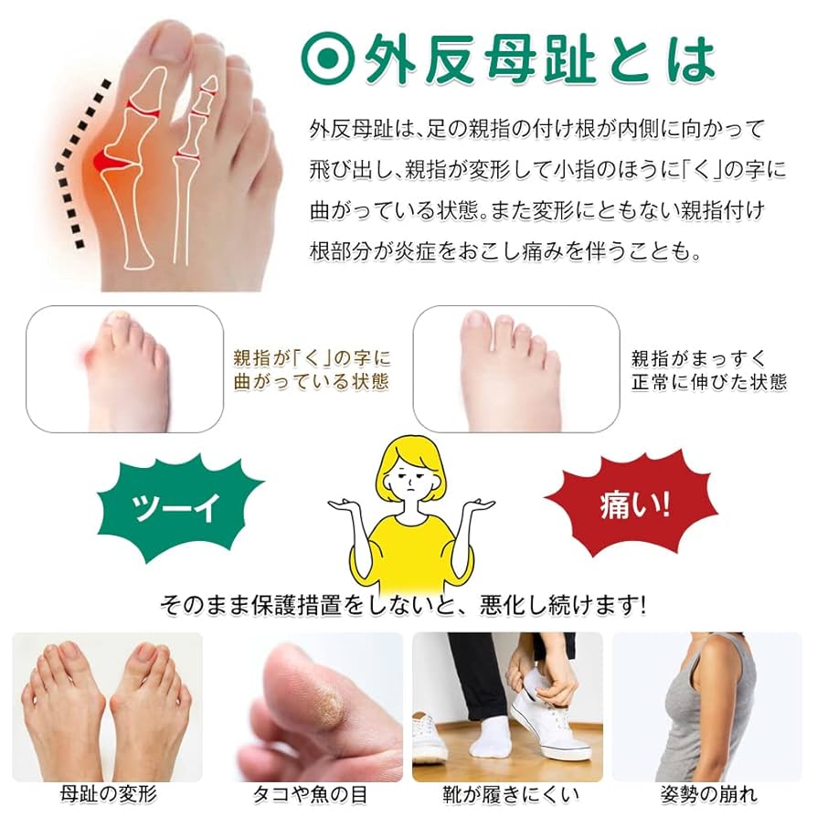 Ｌ　外反母趾サポーター 外反母趾グッズ 親指 母趾サポーター 男女兼用 楽天市場】SALE【3,735円！クーポン利用で】医療機器 外反母趾