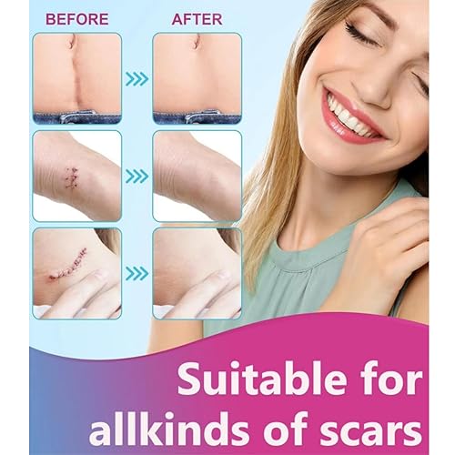 Miniatura 2 de Bokor Hojas de silicona para cicatrices, cinta de silicona para cicatrices quirúrgicas, parches de eliminación de cicatrices con tratamiento de