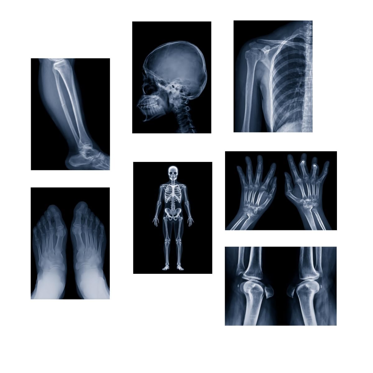 X-ray science education pack for human anatomy and bone parts is suitable for light table and lamp fixtures.