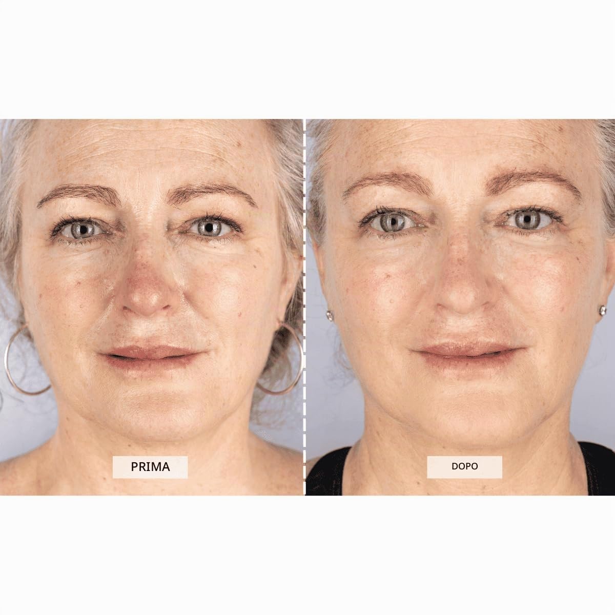 CurrentBody Maschera viso per terapia della luce LED della pelle: serie 1, dispositivo di trattamento per terapia a luce rossa, maschera anti-invecchiamento per ridurre le rughe