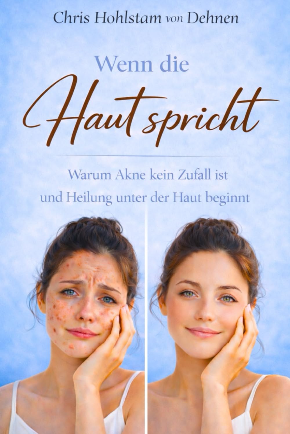 Wenn die Haut spricht: Warum Akne kein Zufall ist und Heilung unter der Haut beginnt