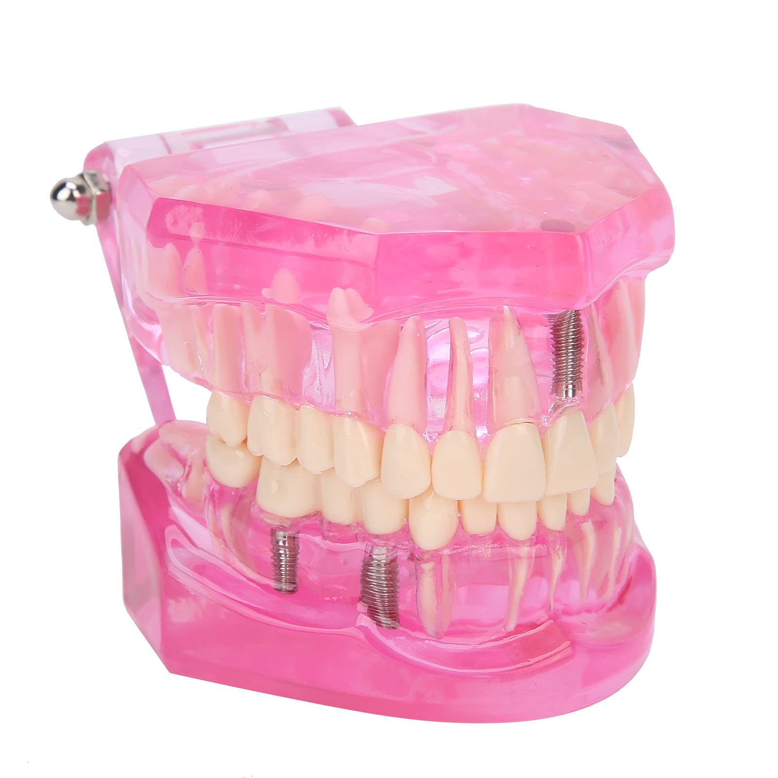 Modello di Denti, Modelli Dentali Per Adulti Trasparenti, Riparazione Studio degli Strumenti in Modalità Denti Dentali, Denti Finti Compatibili Per Insegnamento, Ricerca E Laboratori Odontoiatrici