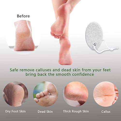 Miniatura 44 de Piedra pómez natural para pies, paquete de 2 herramientas de pedicura de lava, removedor de callos de piel dura para pies y manos, color verde
