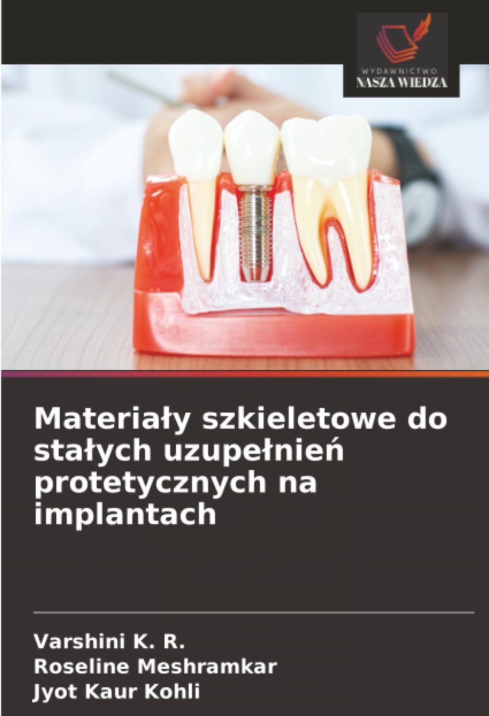 Materialy szkieletowe do stalych uzupelnień protetycznych na implantach