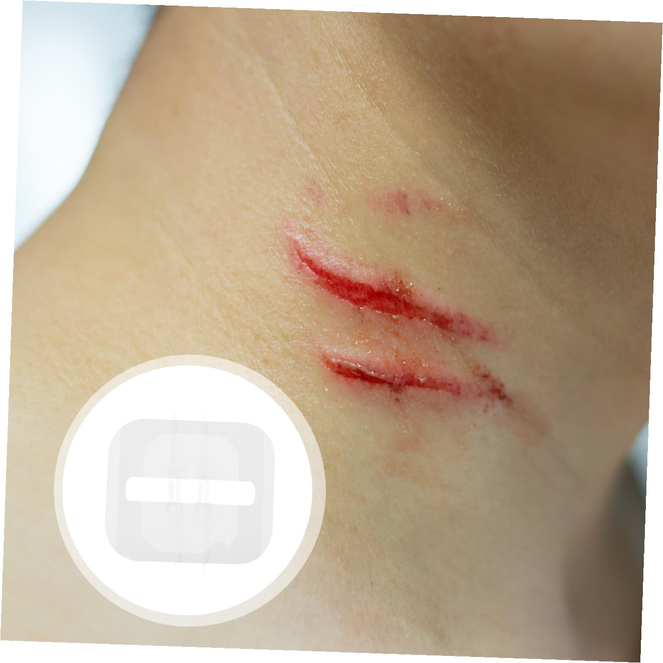 PLAFOPE 2piezas Cierre De Heridas Tiras Adhesivo Para Heridas y Exteriores Fácil De Usar