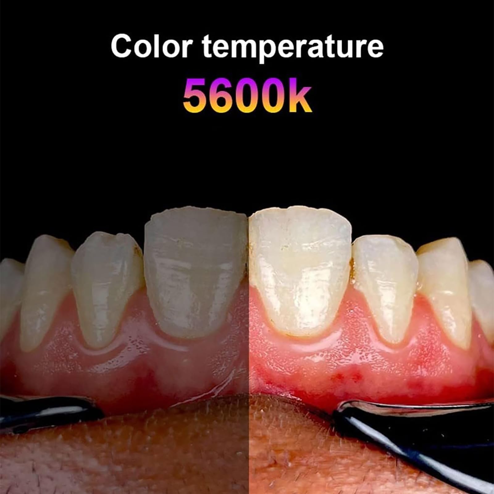 Supporto per fotografia dentale, luce per fotocamera del telefono cellulare con luminosità regolabile e staffa rimovibile, riprese omnidirezionali per odontoiatria e uso ospedaliero