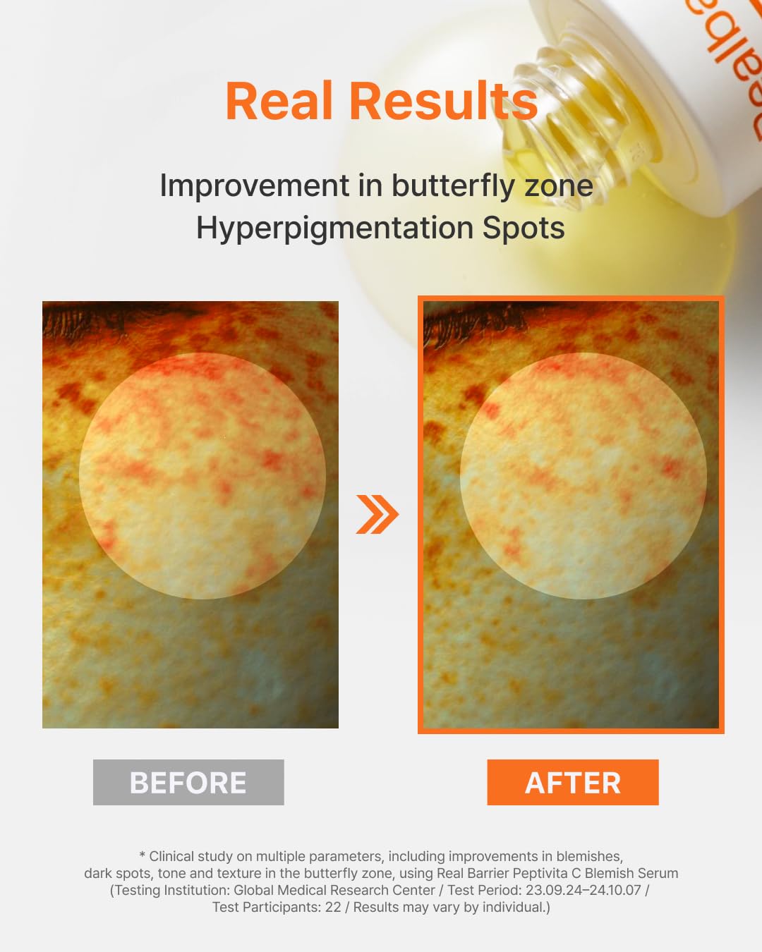 Real Barrier | Peptivita C Blemish Serum | Face Serum for Uneven Skin Tone & Smooth Texture | Vitamin C Face Care for Sensitive Skin | Facial Skin Care Products | Korean Skincare | 1.01 fl oz (30ml) - Image 4