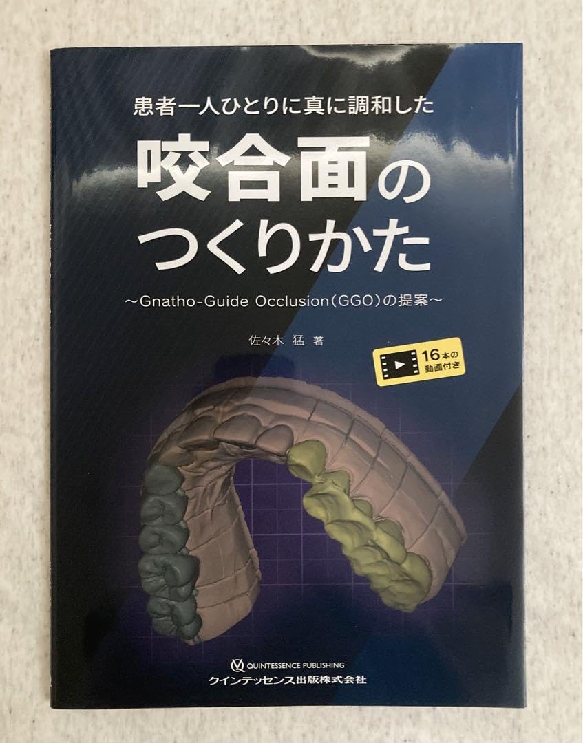 患者一人ひとりに真に調和した咬合面のつくりかた: Gnatho-Guide Occlusion(GGO)の提案 患者一人ひとりに真に調和した咬合面のつくりかた: Gnatho-Guide