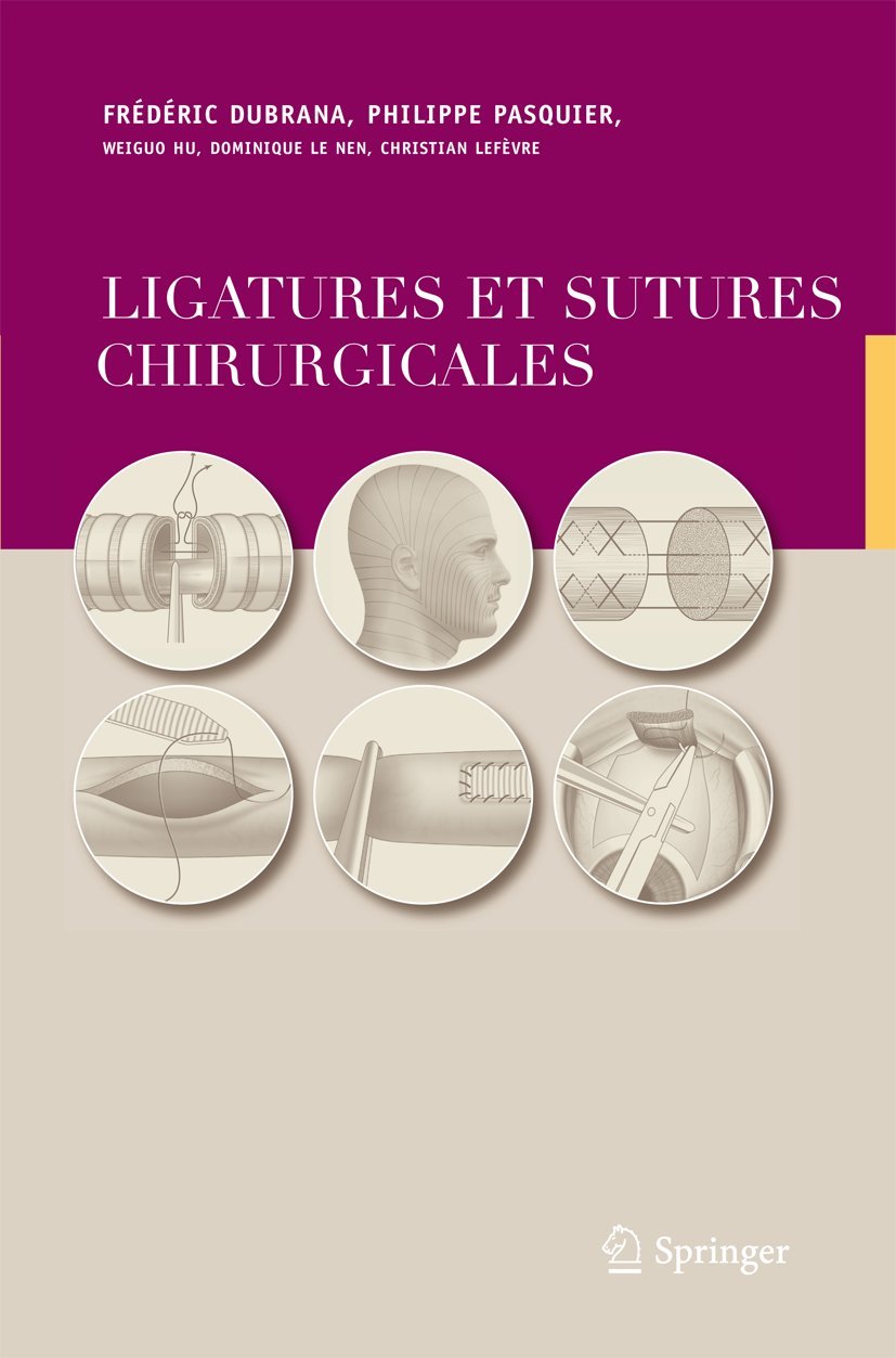 Ligatures et Sutures Chirurgicales: Techniques Chirurgicales (French Edition)