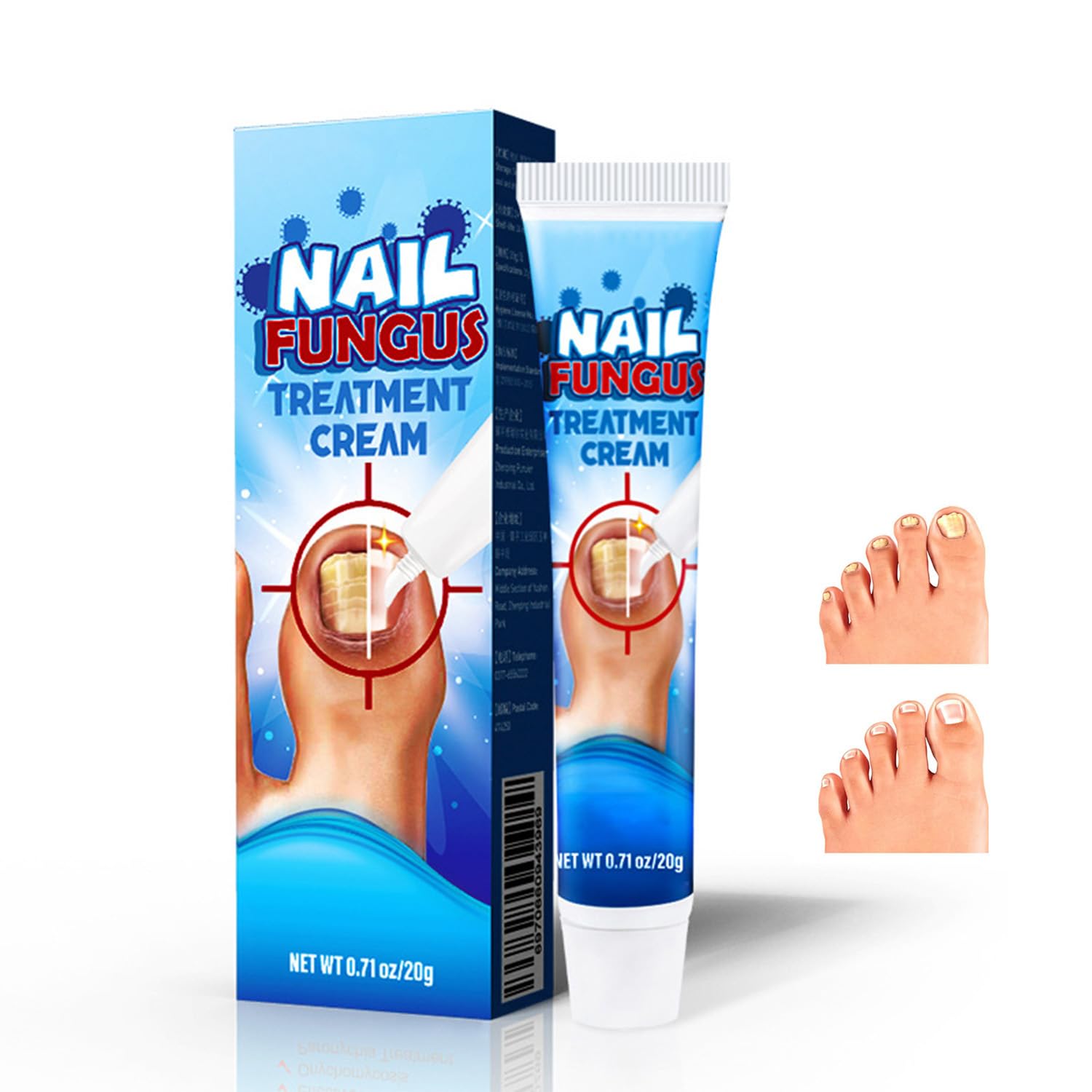 Nail Repair Cream,Fingernail Toenail Care,Strong Anti-Fungal Toenail Cream,Nail Repair Nourishing Treatment,Restores Discolored and Damaged Nails 20g