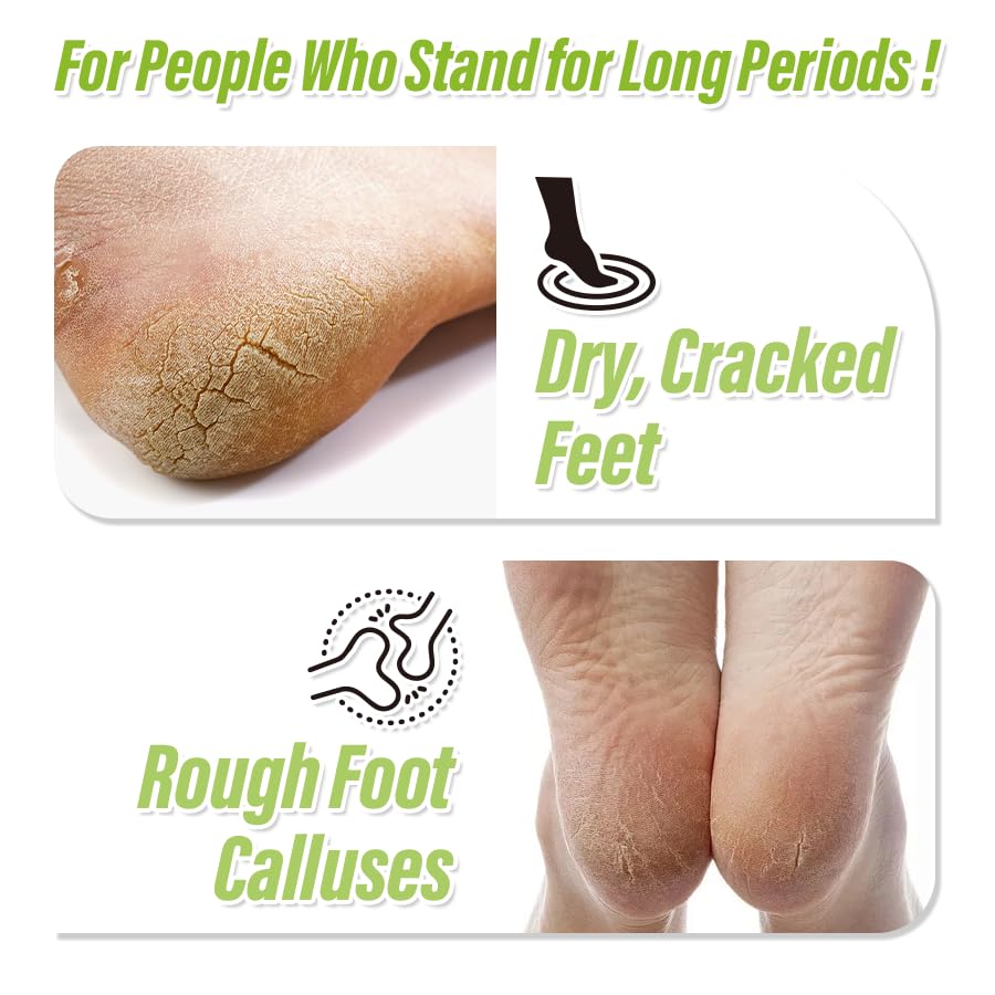 Tea Tree Oil Foot Cream 3.53 oz – Moisturizing & Nourishing Foot Lotion for Dry Cracked Feet, Softens Rough Skin, Soothes & Refreshes Tired Feet - Image 8