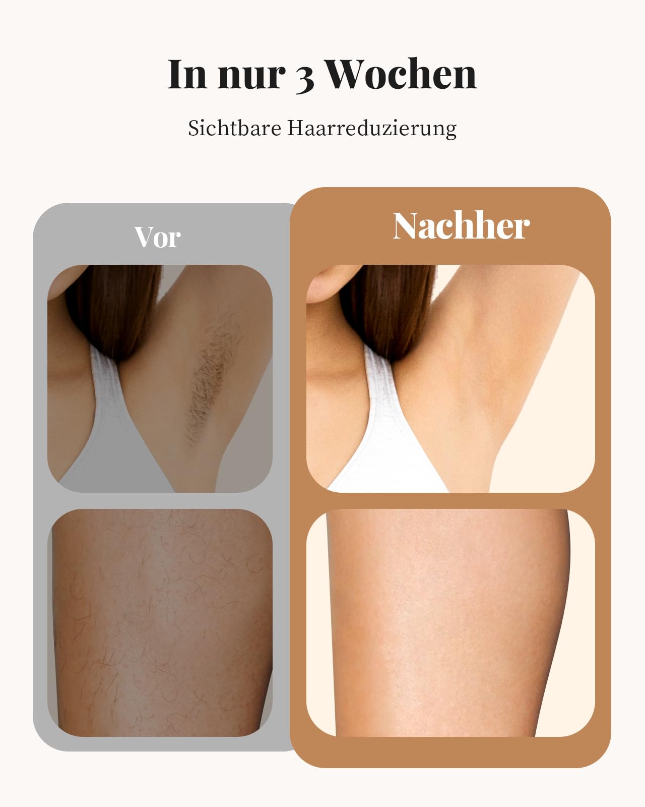 Haarlosy IPL Geräte Haarentfernung Laser für Frauen und Männer mit langanhaltenden Ergebnissen in Salonqualität für zu Hause, schmerzfreies IPL Haarentfernungsgerät für Gesicht, Bikinizone, Körper