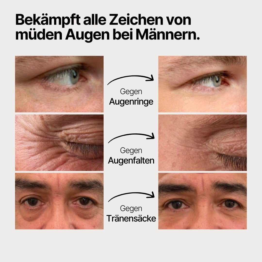 Augenserum Männer gegen Augenringe – Anti Aging Pflege mit Hyaluron, Koffein & Tocopherol – Mildert Schwellungen & Falten – Augencreme mit Soforteffekt – Augenpflege Männer Serum 10 ml