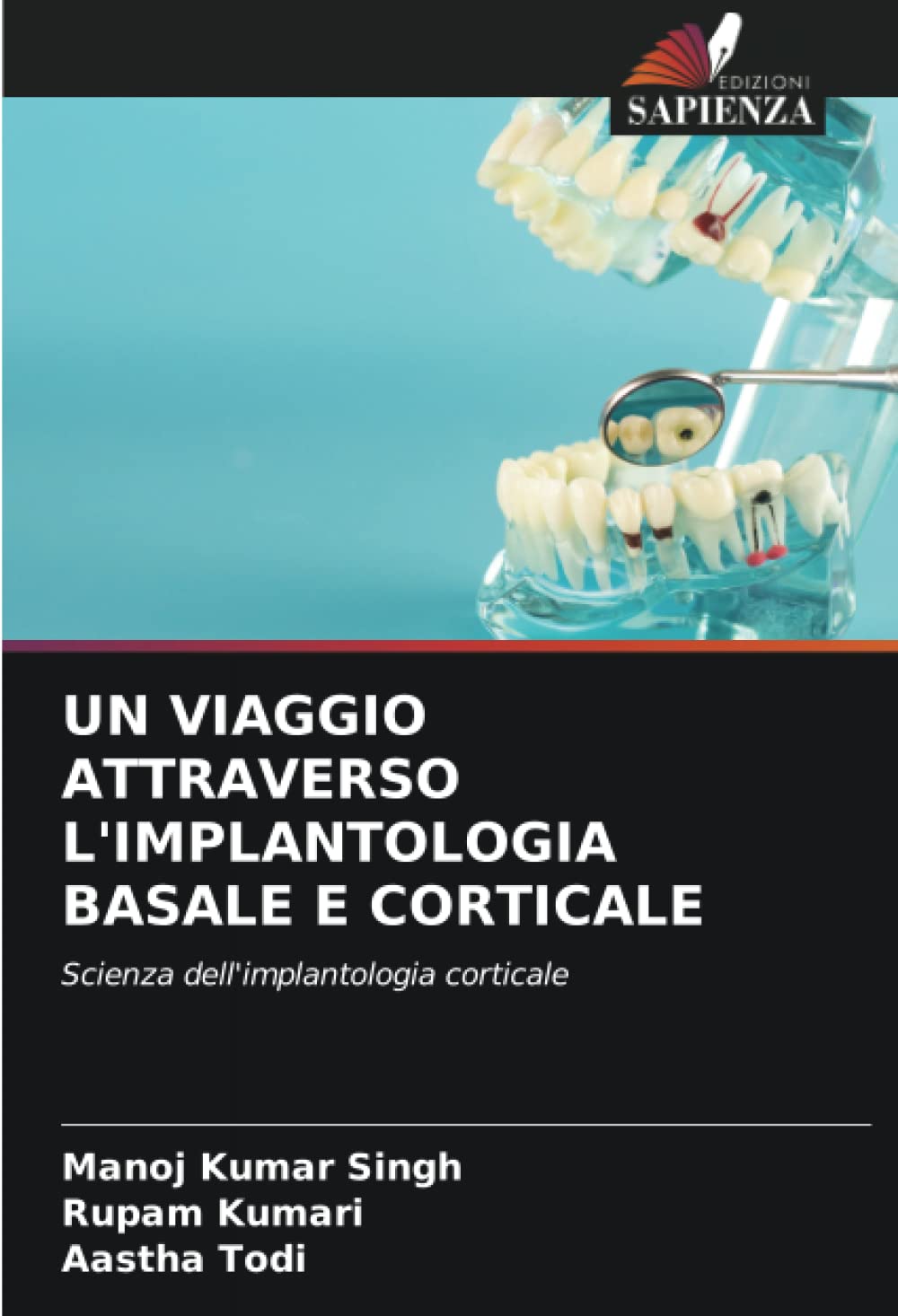 UN VIAGGIO ATTRAVERSO L'IMPLANTOLOGIA BASALE E CORTICALE: Scienza dell'implantologia corticale