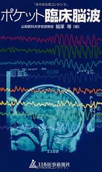 臨床脳波学 Amazon.co.jp: 臨床脳波学 第6版 : 大熊 輝雄: Japanese Books